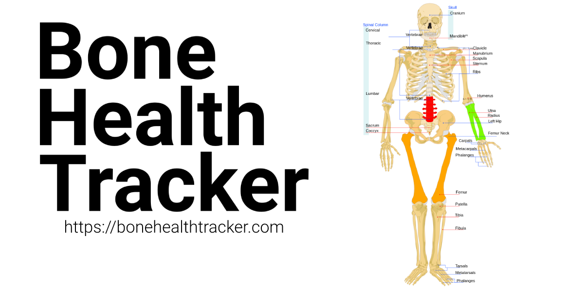 Bone Health Tracker