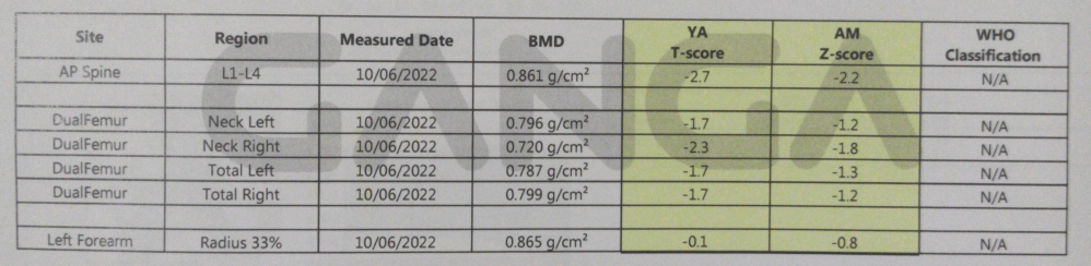 Example of a standard BMD scan assessment section table with only T-scores