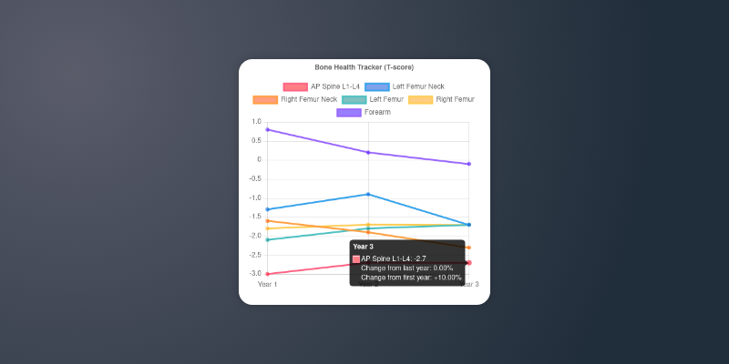 screenshot of a Z-score chart visualization in Bone Health Tracker