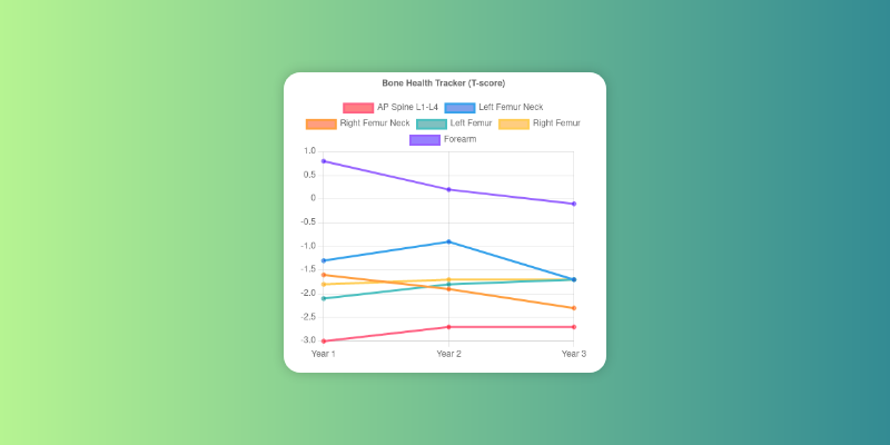 screenshot of a T-score chart visualization in Bone Health Tracker